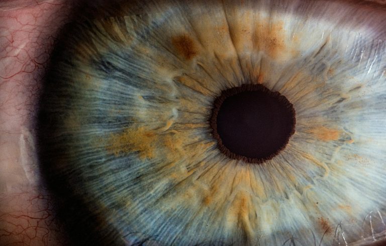 Lentilles de Nuit : Quels Dangers et Comment les Éviter pour une Vue Saine