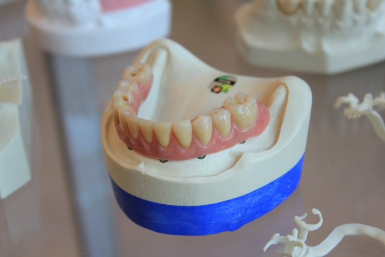 Dépôt Blanc Après Extraction de Dent : Normal ou Inquiétant ? Tout Ce Que Vous Devez Savoir